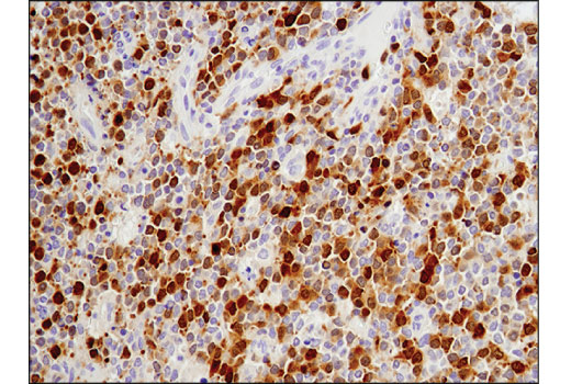 Immunohistochemistry Image 3: Aurora A (D3V7T) XP® Rabbit mAb (BSA and Azide Free)
