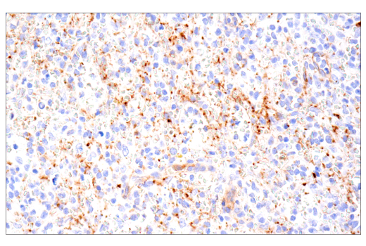 Immunohistochemistry Image 9: CD109 (E4I2V) Rabbit mAb (BSA and Azide Free)