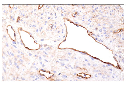 Immunohistochemistry Image 10: CD109 (E4I2V) Rabbit mAb (BSA and Azide Free)
