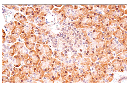 Immunohistochemistry Image 4: p70 S6 Kinase (E8K6T) XP® Rabbit mAb