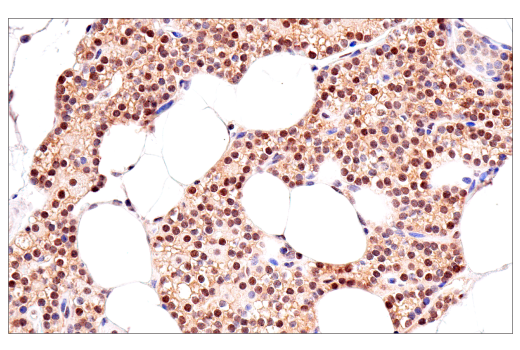  Image 39: Phospho-Tau (Ser214/T217) Signaling Antibody Sampler Kit