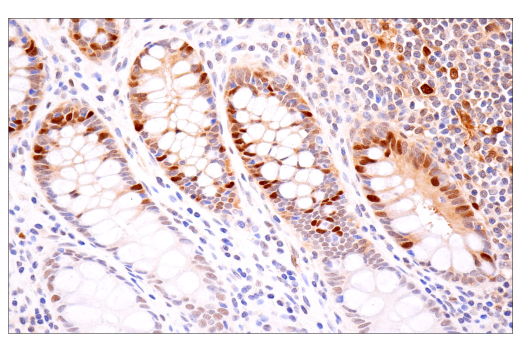 Immunohistochemistry Image 1: CDK2 (E8J9T) XP® Rabbit mAb (BSA and Azide Free)