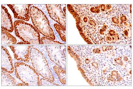 Immunohistochemistry Image 4: CDK2 (E8J9T) XP® Rabbit mAb (BSA and Azide Free)