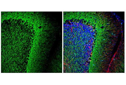 Immunofluorescence Image 1: Neurofilament-M (E9N8K) Mouse mAb