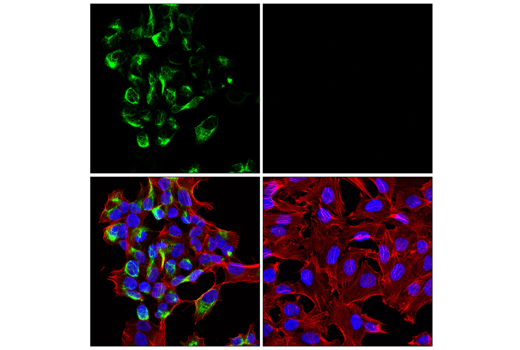 Immunofluorescence Image 2: Neurofilament-M (E9N8K) Mouse mAb