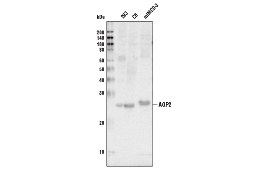 Western Blotting Image 1: AQP2 Antibody