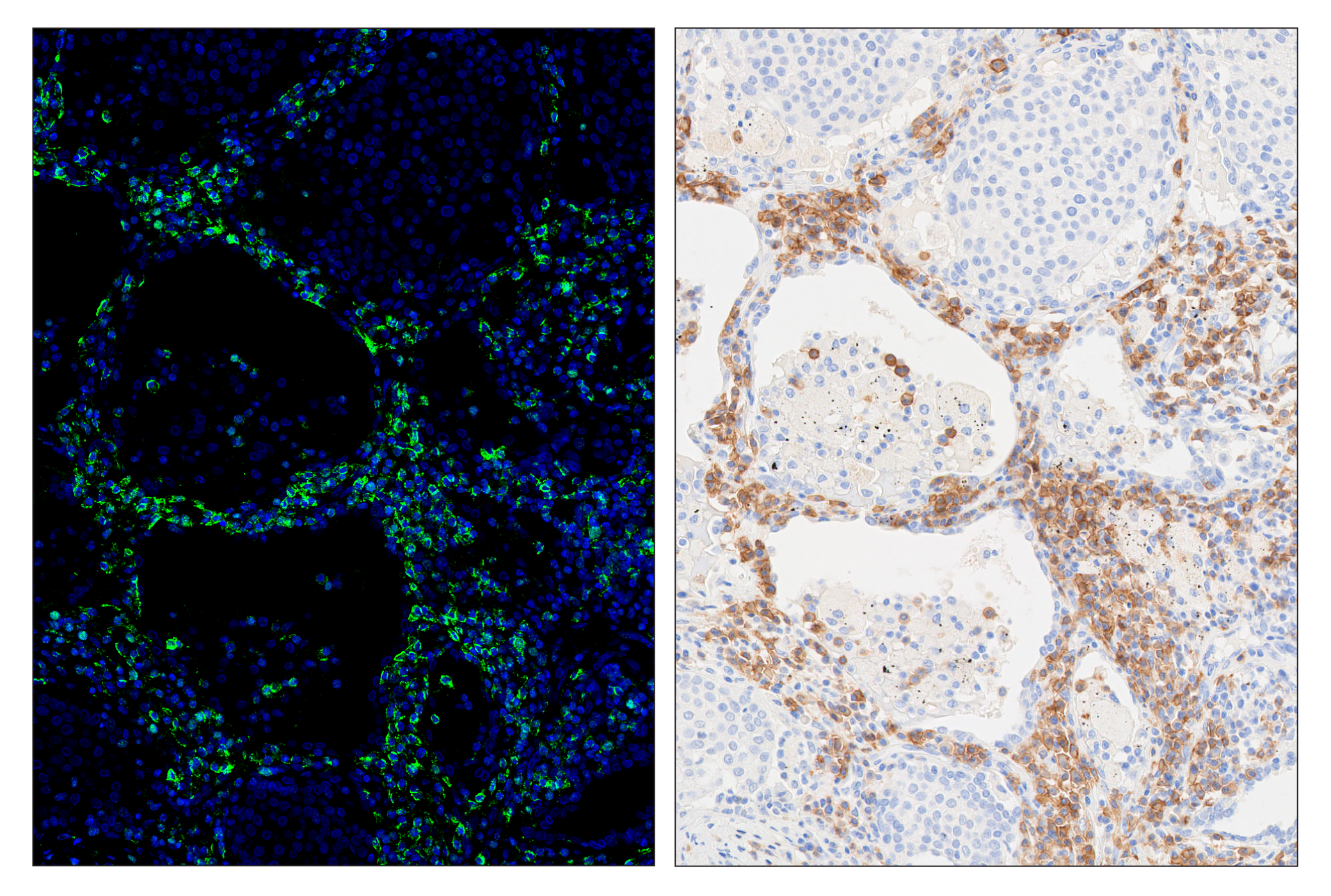 Immunohistochemistry Image 5: CD19 (Intracellular Domain) (D4V4B) & CO-0054-594 SignalStar™ Oligo-Antibody Pair