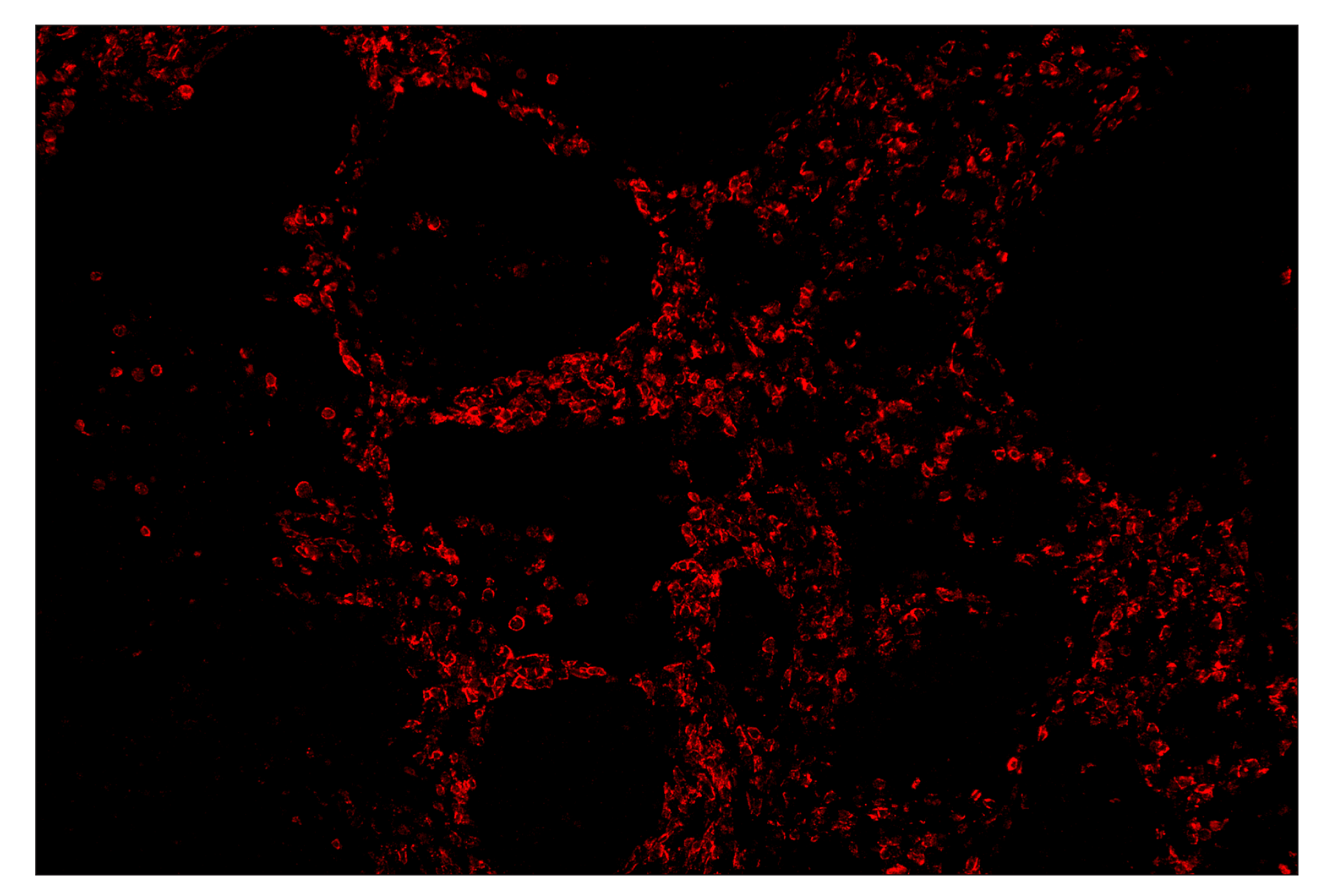 Immunohistochemistry Image 3: CD19 (Intracellular Domain) (D4V4B) & CO-0054-647 SignalStar™ Oligo-Antibody Pair
