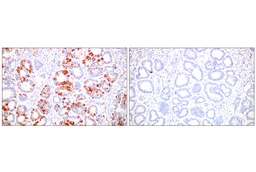 Immunohistochemistry Image 8: Phospho-CrkL (Tyr207) (E9A1U) XP® Rabbit mAb