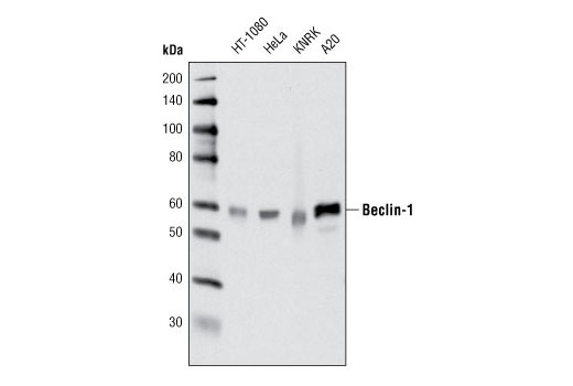  Image 5: ULK1 Substrate Antibody Sampler Kit
