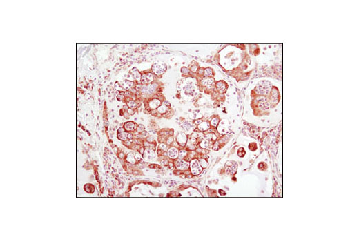  Image 13: HSP/Chaperone Antibody Sampler Kit