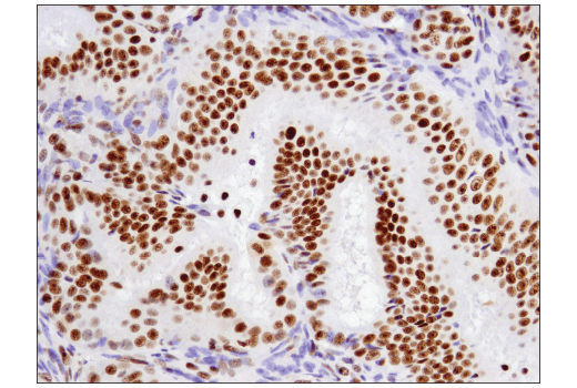 Immunohistochemistry Image 3: ATF-2 (D4L2X) XP® Rabbit mAb