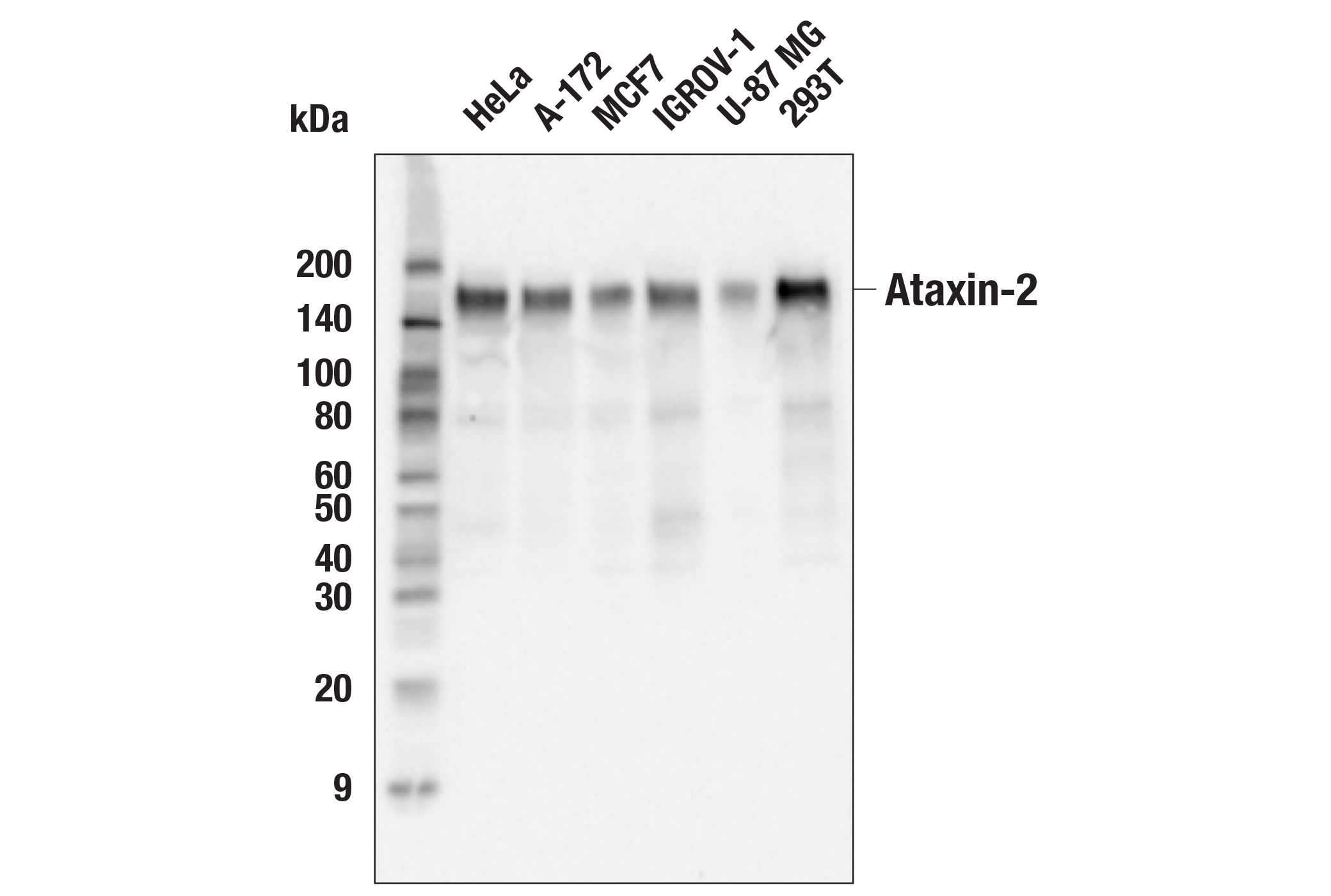 Western Blotting Image 1: Ataxin-2 (E3B3Z) Rabbit mAb