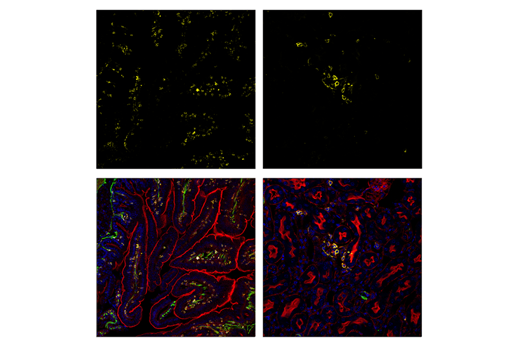 Immunofluorescence Image 1: CD45 (D3F8Q) Rabbit mAb (Alexa Fluor® 594 Conjugate)
