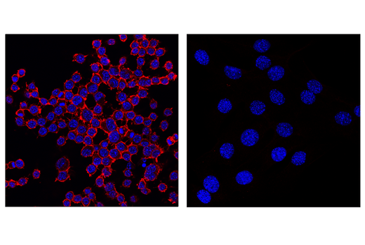 Immunofluorescence Image 2: CD45 (D3F8Q) Rabbit mAb (Alexa Fluor® 594 Conjugate)