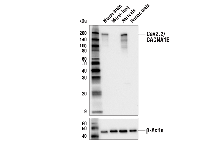Western Blotting Image 1: Cav2.2/CACNA1B Antibody