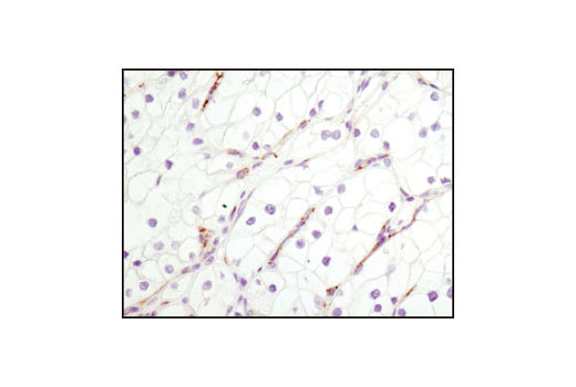 Immunohistochemistry Image 3: CD31 (PECAM-1) (89C2) Mouse mAb