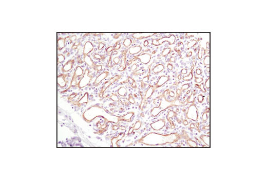 Immunohistochemistry Image 4: CD31 (PECAM-1) (89C2) Mouse mAb