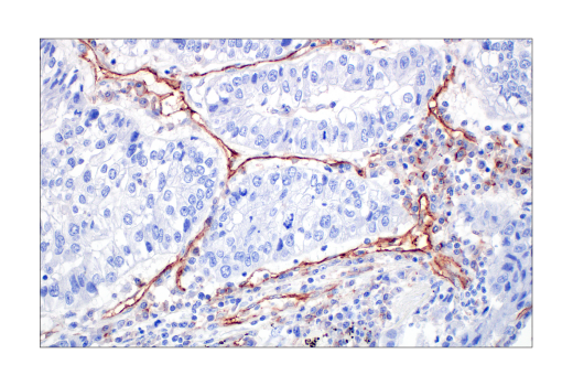 Immunohistochemistry Image 7: CD31 (PECAM-1) (89C2) Mouse mAb