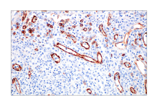 Immunohistochemistry Image 8: CD31 (PECAM-1) (89C2) Mouse mAb