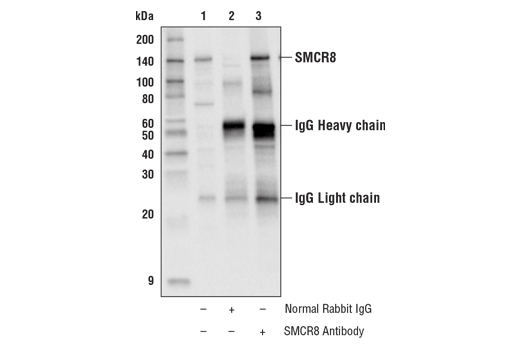 Immunoprecipitation Image 1: SMCR8 Antibody