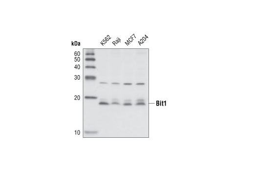 Western Blotting Image 2: Bit1 Antibody