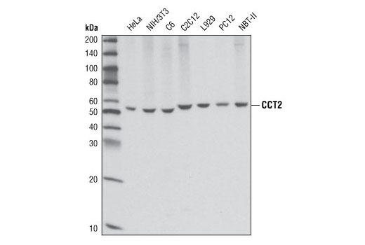 Western Blotting Image 1: CCT2 Antibody