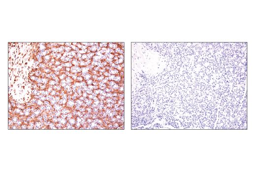 Immunohistochemistry Image 1: CRMP-2 (D8L6V) Rabbit mAb