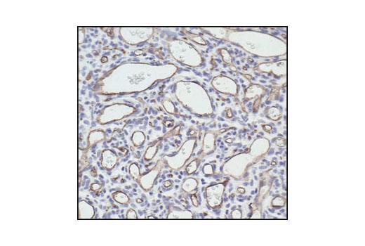 Immunohistochemistry Image 1: CD34 (ICO115) Mouse mAb