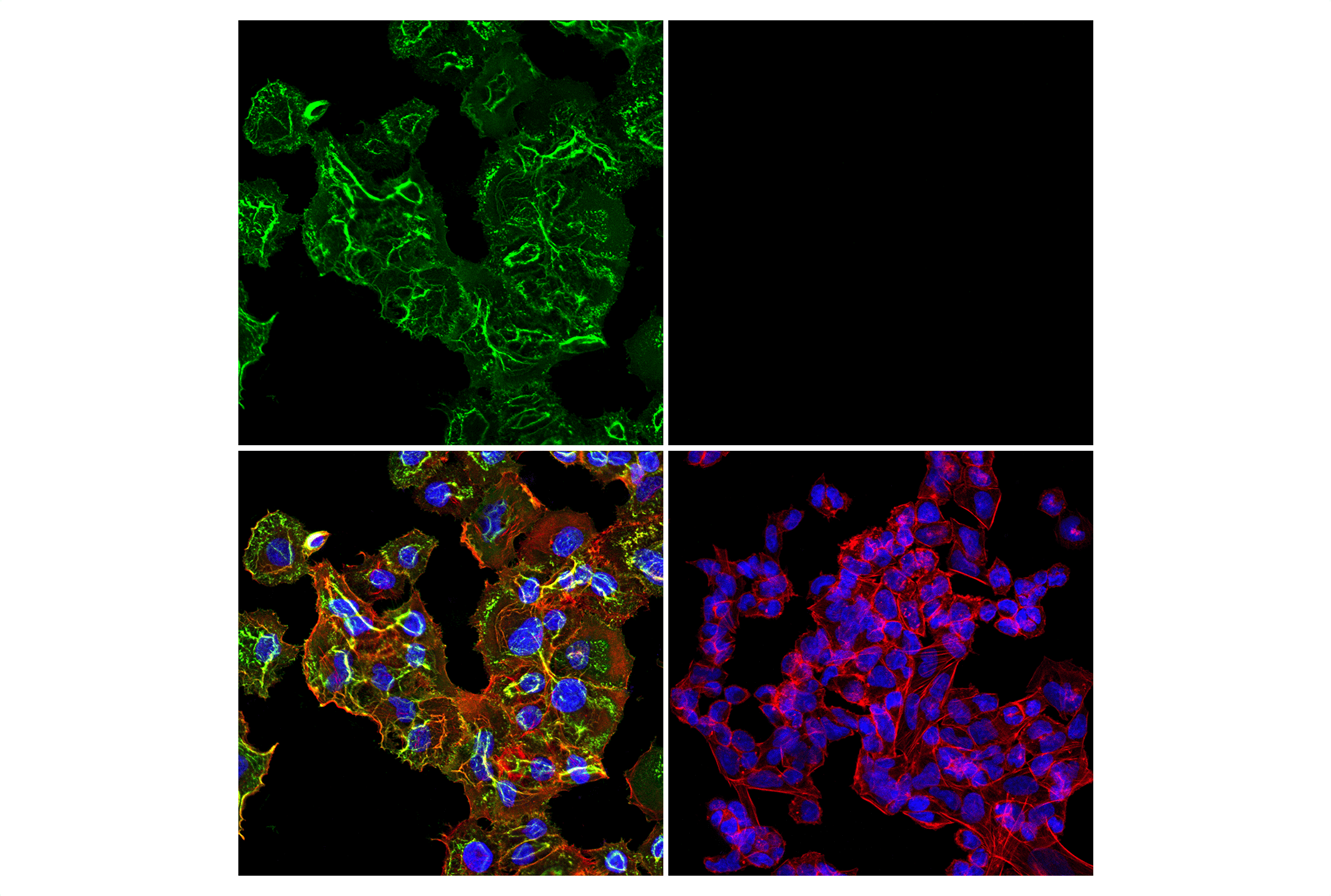 Immunofluorescence Image 1: CD44 (156-3C11) Mouse mAb
