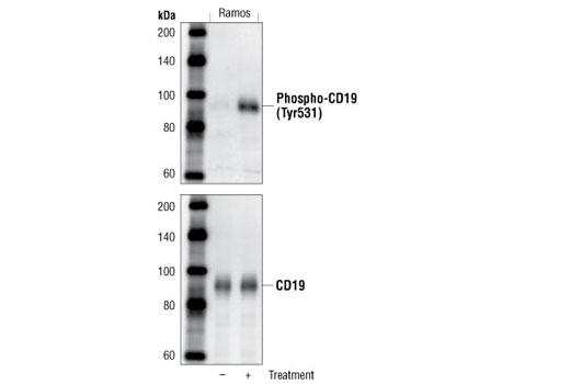 Western Blotting Image 1: Phospho-CD19 (Tyr531) Antibody