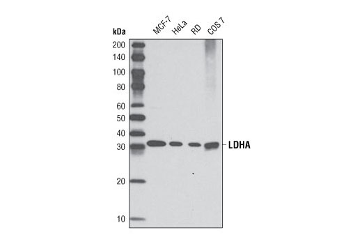  Image 7: Hypoxia Activation IHC Antibody Sampler Kit
