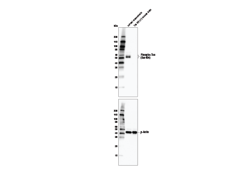  Image 6: Phospho-Tau Family Antibody Sampler Kit