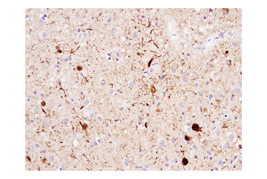 Immunohistochemistry Image 1: Phospho-Tau (Ser404) (D2Z4G) Rabbit mAb