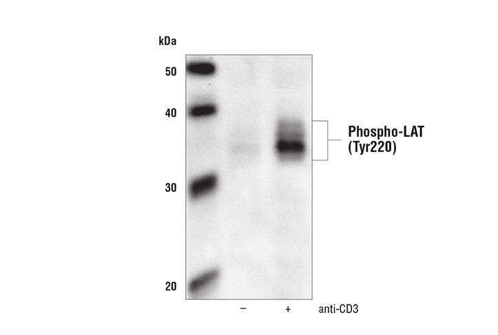 Western Blotting Image 1: Phospho-LAT (Tyr220) Antibody