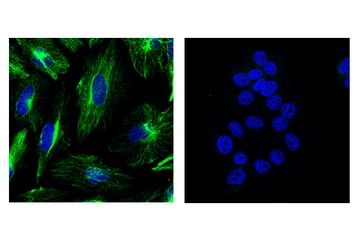 Immunofluorescence Image 1: Nestin (10C2) Mouse mAb (Alexa Fluor® 488 Conjugate)