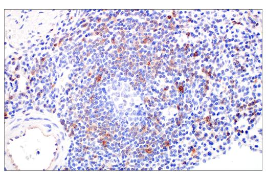 Immunohistochemistry Image 6: CD70 (E3Q1A) Rabbit mAb (BSA and Azide Free)