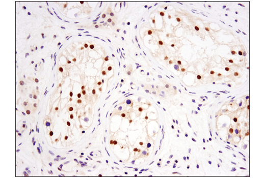 Immunohistochemistry Image 4: DNMT3A (D23G1) Rabbit mAb