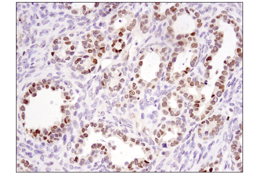 Immunohistochemistry Image 6: DNMT3A (D23G1) Rabbit mAb