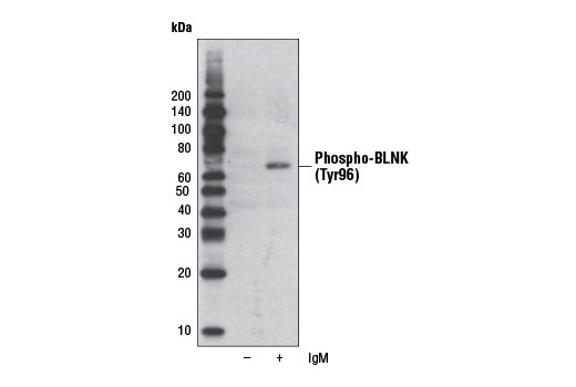 Western Blotting Image 1: Phospho-BLNK (Tyr96) Antibody