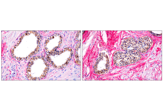 Immunohistochemistry Image 1: SignalStain® IHC Dual Staining Kit (AP, Rabbit, Red / HRP, Mouse, Brown)