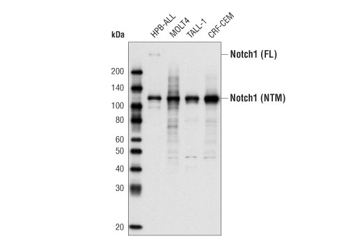  Image 1: PhosphoPlus® Notch1 (Cleaved, Val1744) Antibody Duet