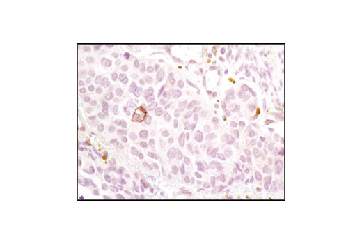  Image 5: PhosphoPlus® Notch1 (Cleaved, Val1744) Antibody Duet