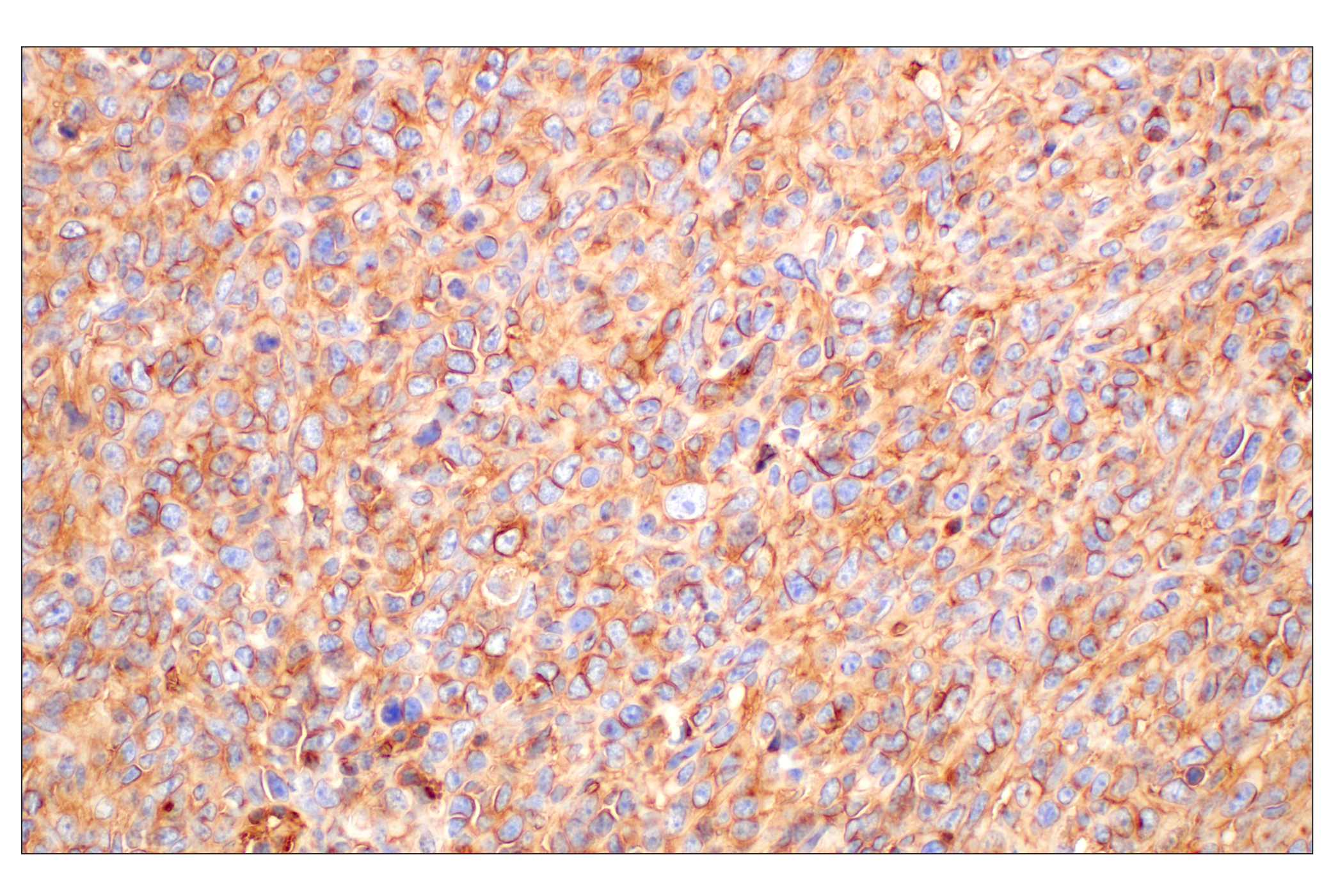 Immunohistochemistry Image 6: CD47 (E2V9V) Rabbit mAb
