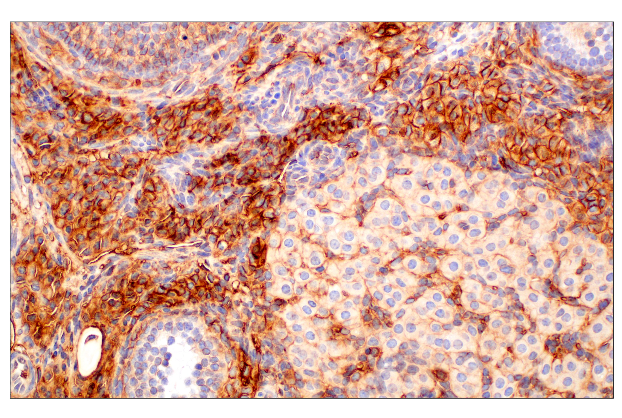 Immunohistochemistry Image 3: CD47 (E2V9V) Rabbit mAb