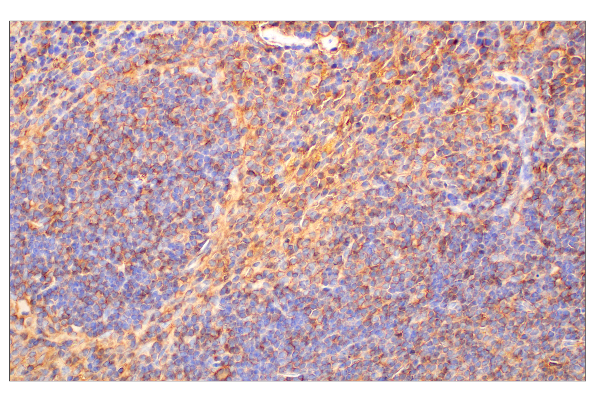 Immunohistochemistry Image 2: CD47 (E2V9V) Rabbit mAb