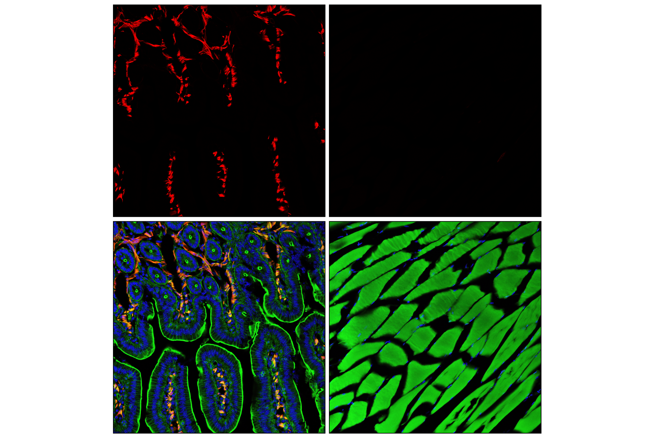 Immunofluorescence Image 1: α-Smooth Muscle Actin (D4K9N) XP® Rabbit mAb (Alexa Fluor® 594 Conjugate)