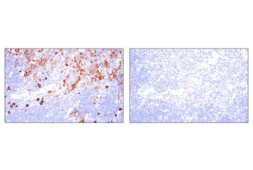 Immunohistochemistry Image 4: IL-2Rα/CD25 (E4B2Z) XP® Rabbit mAb
