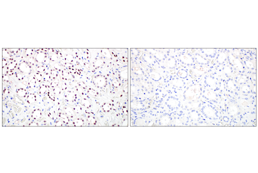  Image 73: Small Cell Lung Cancer Biomarker Antibody Sampler Kit