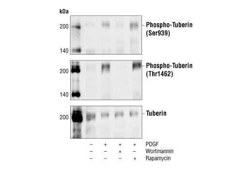  Image 6: Insulin/IGF-1 Signaling Pathway Antibody Sampler Kit